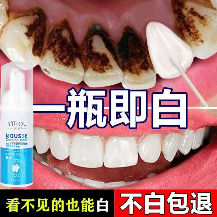 最新去牙垢,最新去牙垢，从齿间焕新，到人生焕然